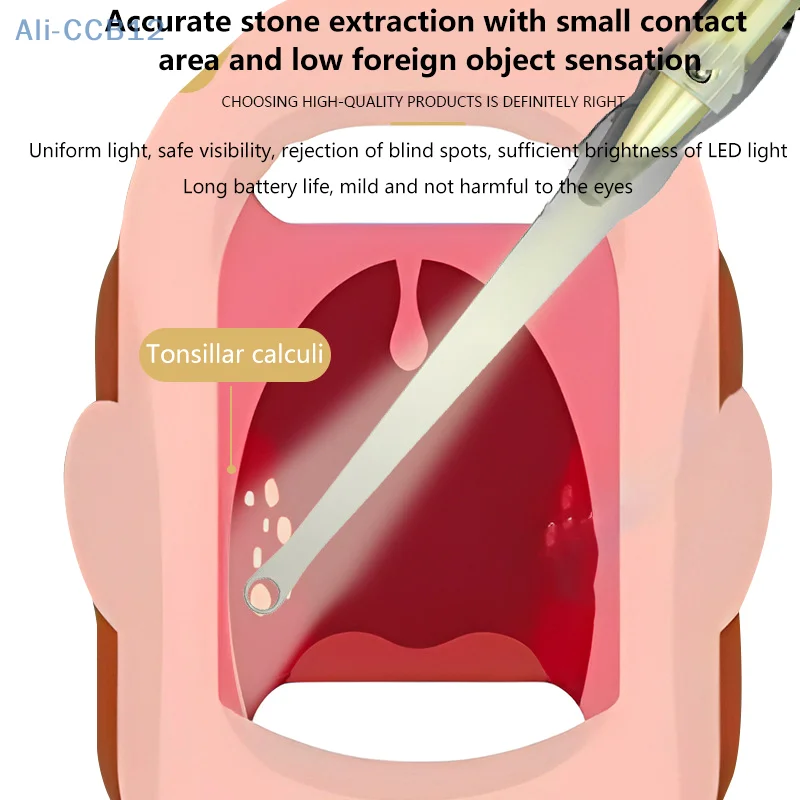 Ferramenta removedora de pedra de amígdala, luz led, removedor de pedra de amígdala, aço inoxidável, ferramentas de cuidados de limpeza bucal