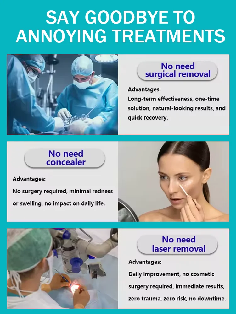 Ceramide Repairing Eye Cream Strengthens Barrier Hot Selling in 2025