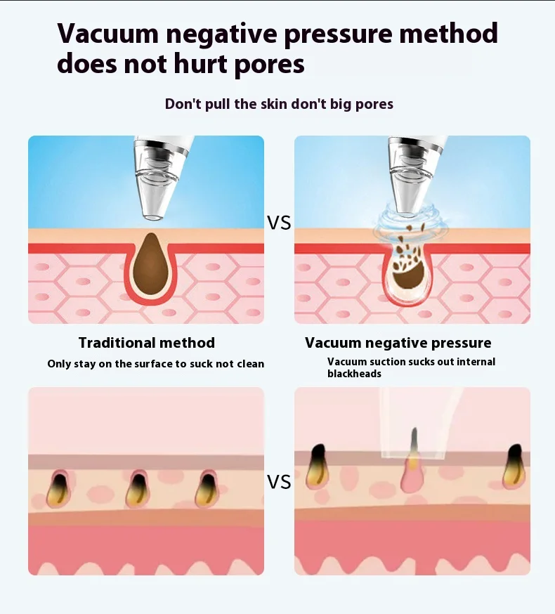 Rechargeable blackhead remover LCD display ultra-micro home beauty shrink pores clean acne blackhead remover