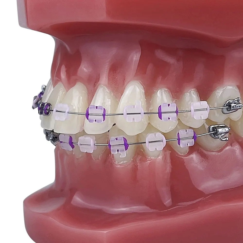 Dentystyczne ze wspornikiem ortodontycznym Model zębów metalowo/ceramicznym samozamykające się leczenie stomatologiczne do nauczania studiowania Demo