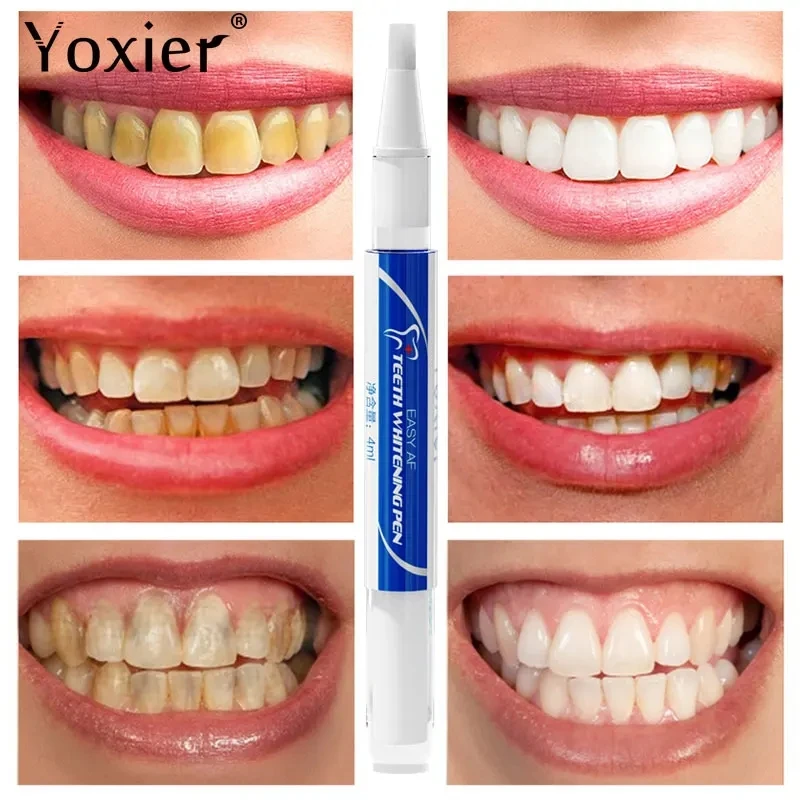 Tooth Whitening Pen Dazzling White Teeth Whitening Pen Instant Teeth Whitening Pen Brighten Your Smile Tooth Hygiene Care Tools