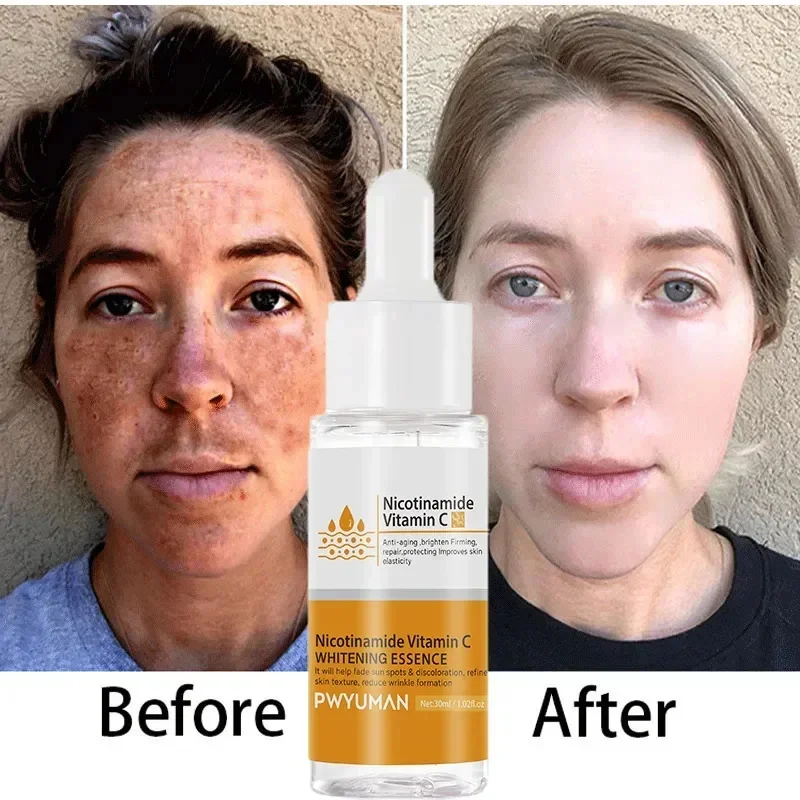 Vitamine C Whitening Sproeten Serumcrème Verwijderen Donkere Vlekken Melasma Niacinamide Lichter Melanine Acne Littekens Anti-Aging Huidverzorging