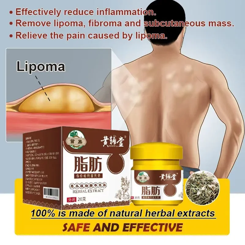 New Anti-Swelling Lipoma Removal Cream Lymphatic Drainage Detox Breast Lymph Nodes Subcutaneous Lumps