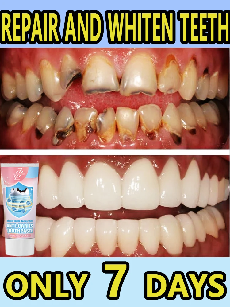 

Натуральные травы, здоровое отбеливание, делает свою улыбку, ярче!