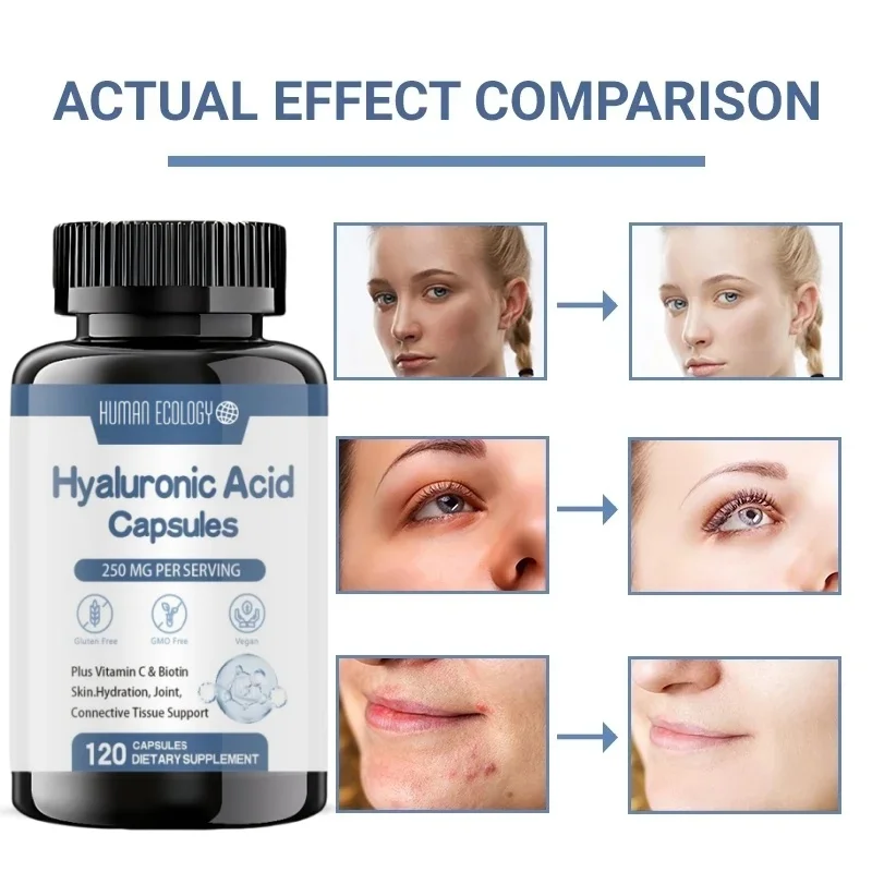 Hyaluronic Acid Capsules with Biotin & Vitamin C Improve Rough Skin Care, Joint Lubrication