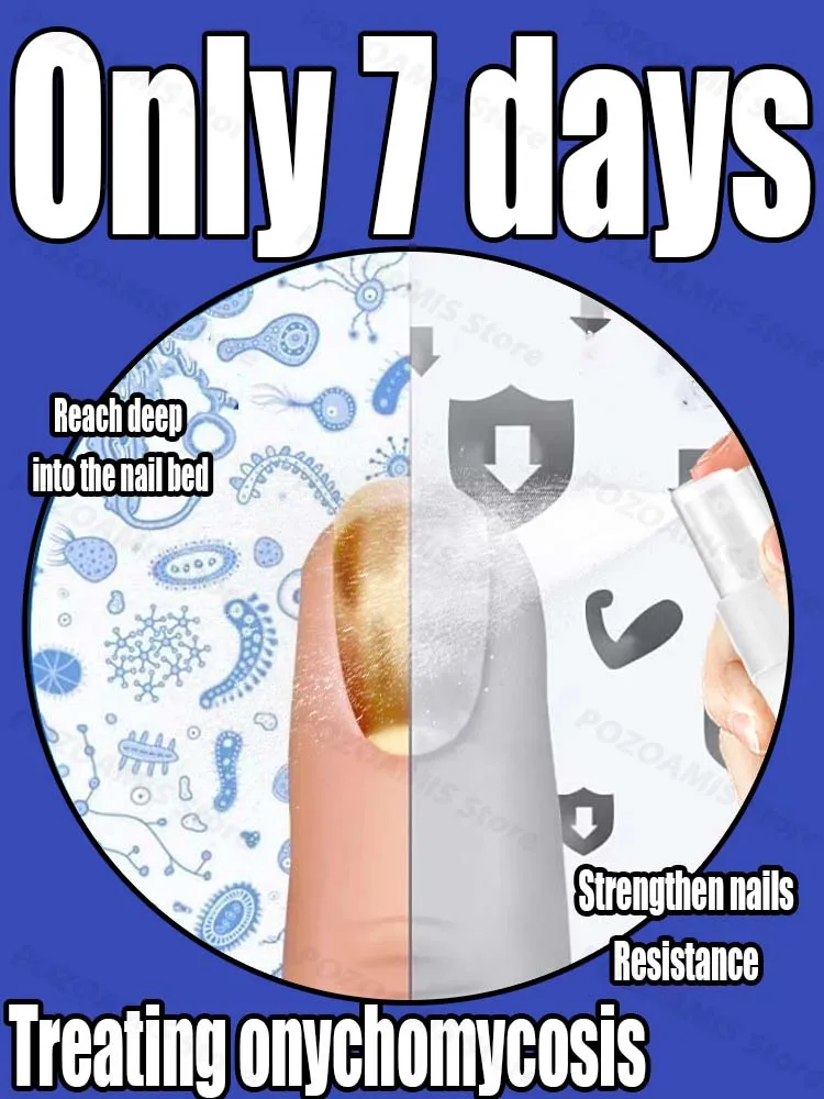 Pure plantaardige etherische olie-extractie, diepe penetratie, ontwakende vitaliteit, veilig en zorgeloos