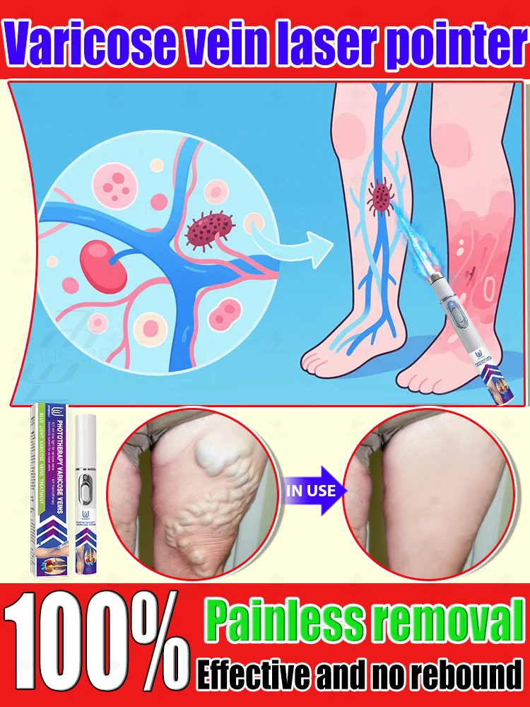 

Здоровье обратных ног за 7-днем и покажи прощай, чтобы варикозное расширение вен.