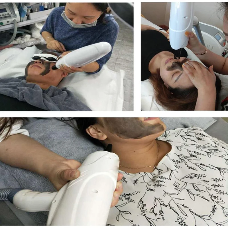 جل تقشير الكربون لتجديد شباب البشرة جل كربون أسود للتنظيف العميق 80 جرام لآلة الليزر Nd Yag Pico كريم تقشير الكربون