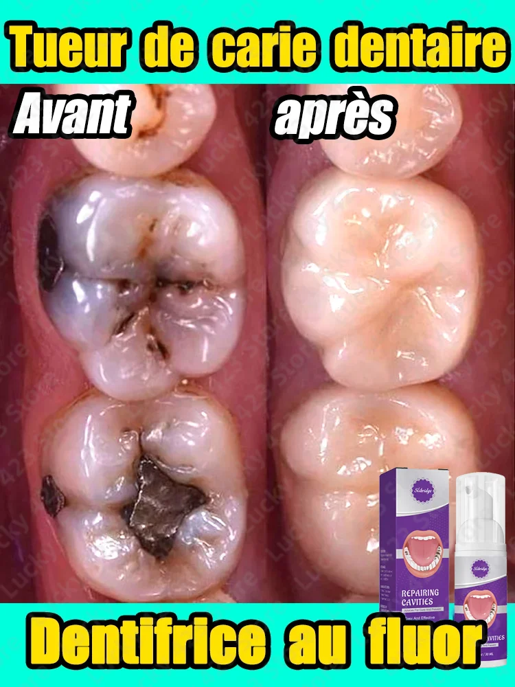 

Dental Caries Repair Cream