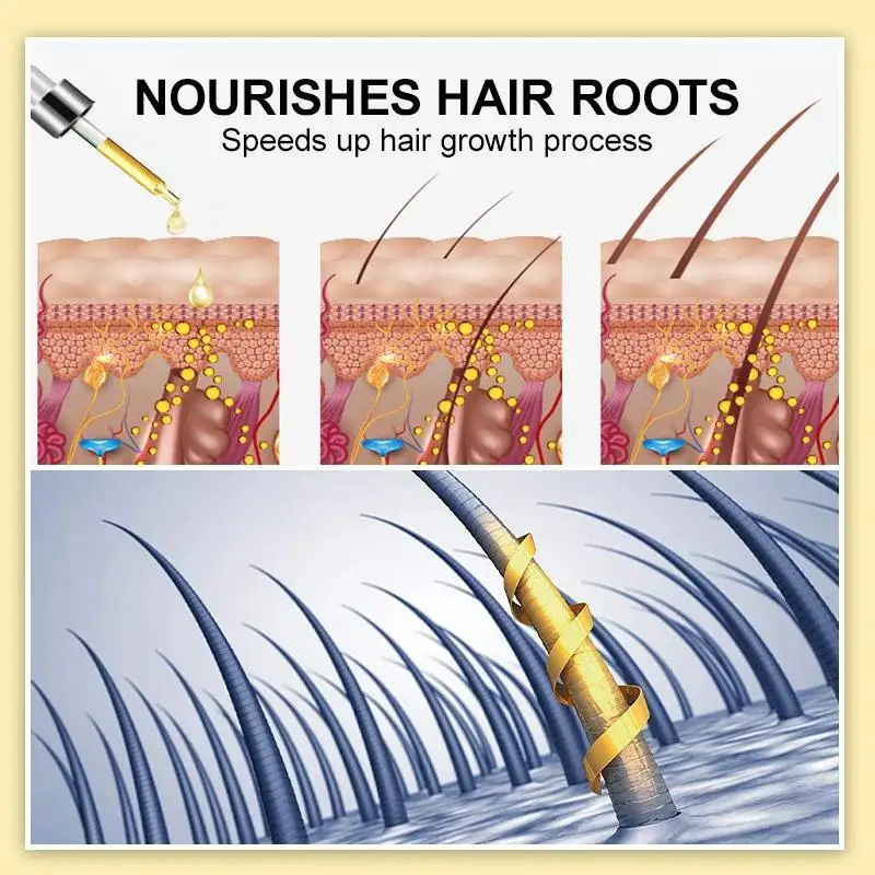 Ginger Hair Growth Product Anti-loss Hair Regrowth Serum Oil Fast Grow Prevent Baldness Treatment Alopecia Men Women Hair Care