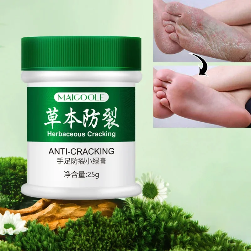 Hand Foot Anti-Cracking Green Cream Improve Dry Rough Smooth Repair Care Ointment Exfoliation Dead Skin Heel Cracked Moisturizer