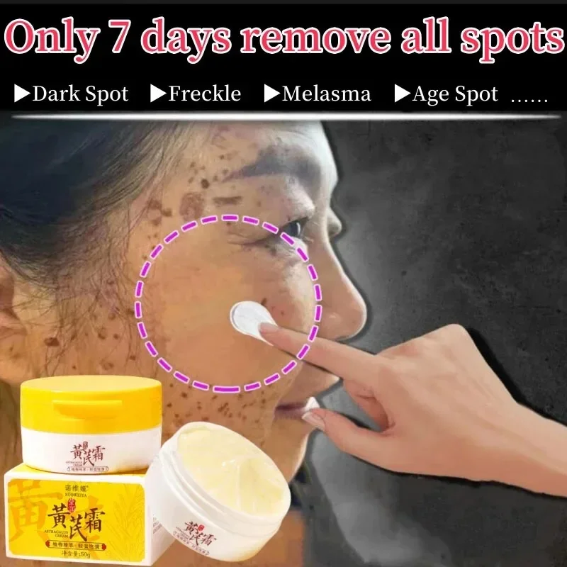 Astragalus Whitening Freckle Cream Face Remove Dark Spots Melasma Lighten Melanin Acne Scars Anti-aging Brighten Black Skin Care