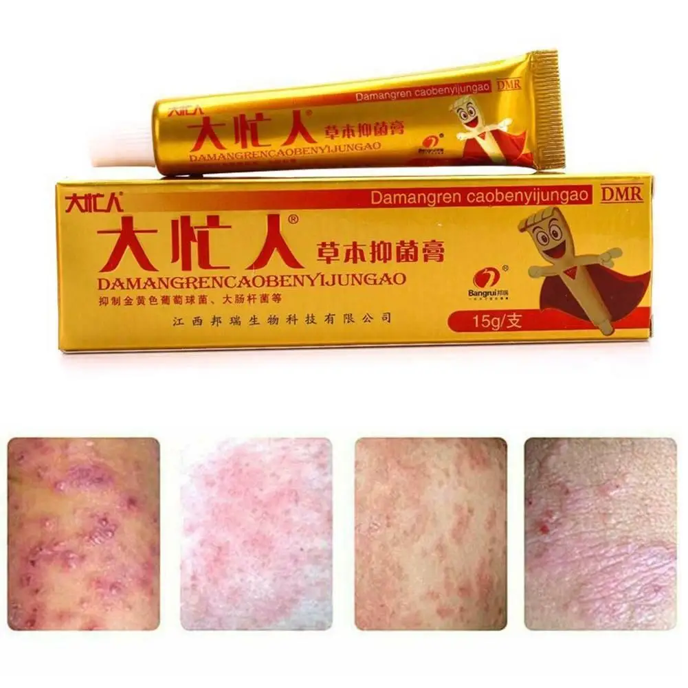 Damangren Herbal Antibacterial Creams Psoriasis Skin Cream Dermatitis Eczema Pruritus Ointments Herbal Antibacterial Skin Care