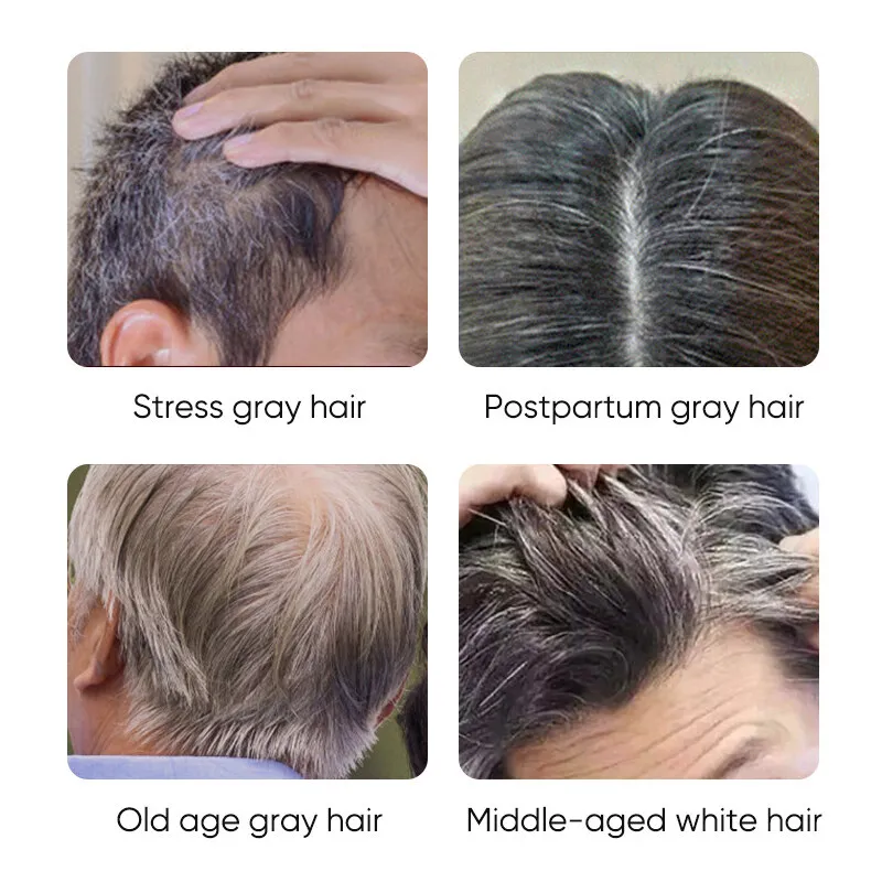 Gray White Hair Repair Serum Soap Fast White To Black Repair Nourish Beard Hair Roots Shampoo Men Women Beauty Health Care view 3