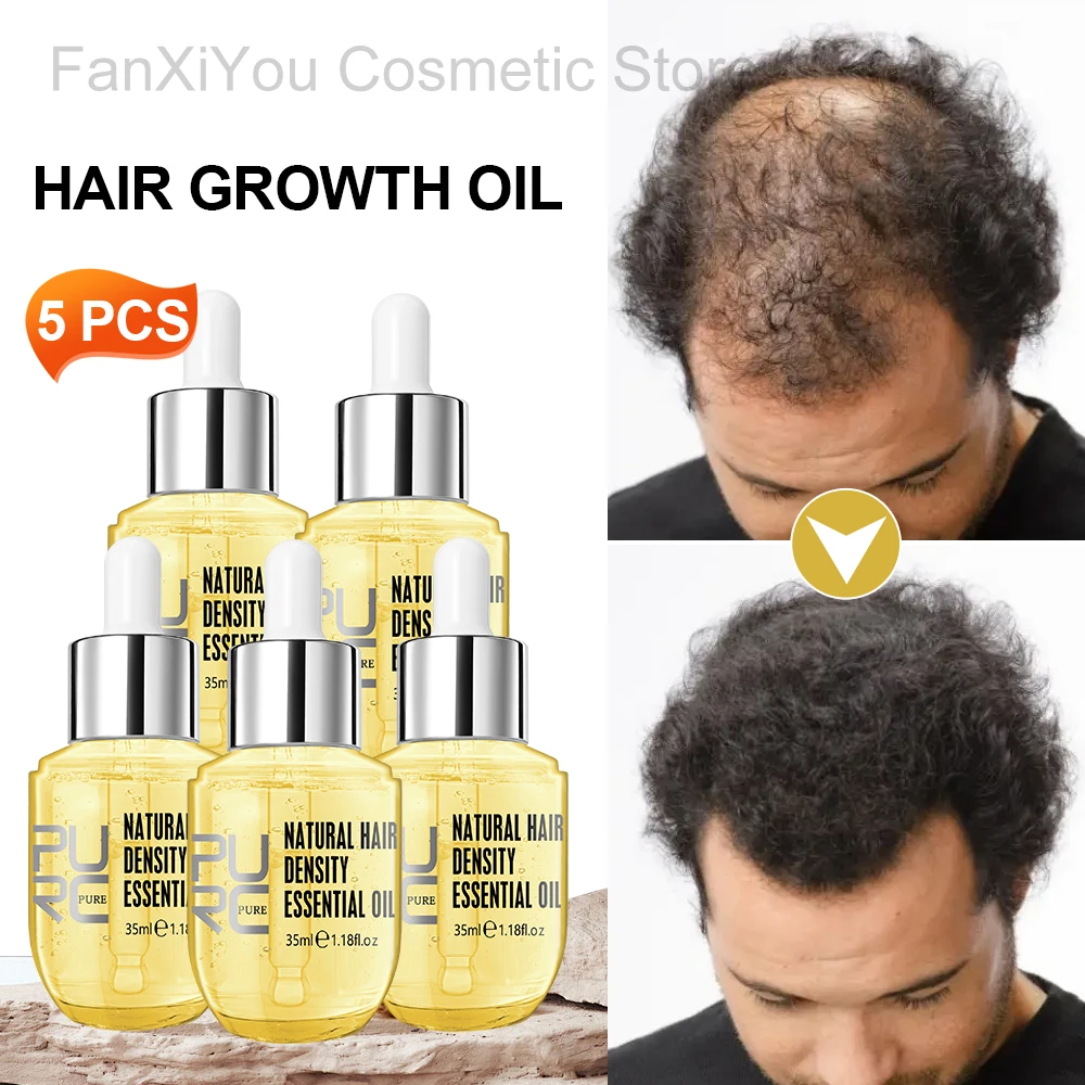 

PURC Имбирное масло для ухода за волосами Мужчины Женщины Укрепляет слабые пряди волос Сыворотка для лечения кожи головы Утолщенное масло против выпадения волос 35 мл