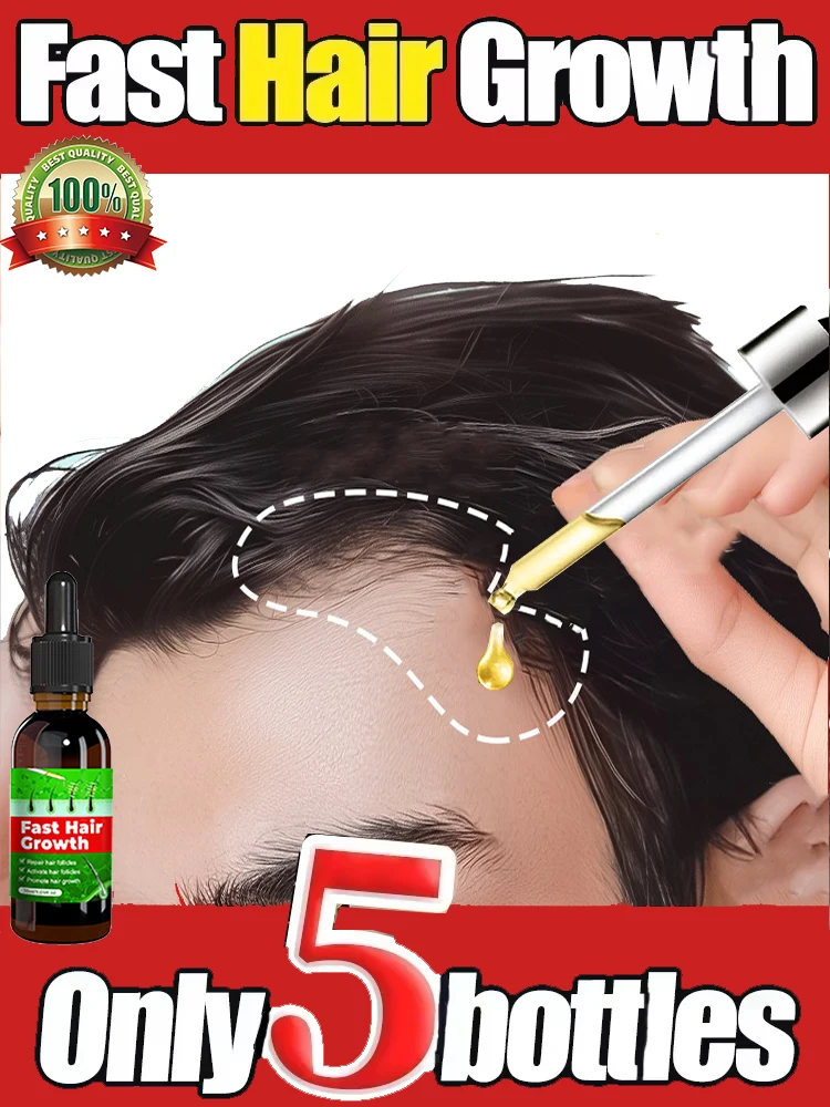 

Effective Fast Hair Growth Serum Baldness Repair Hereditary Postpartum Seborrheic Anti Loss Care for Men Women Scalp Cares3