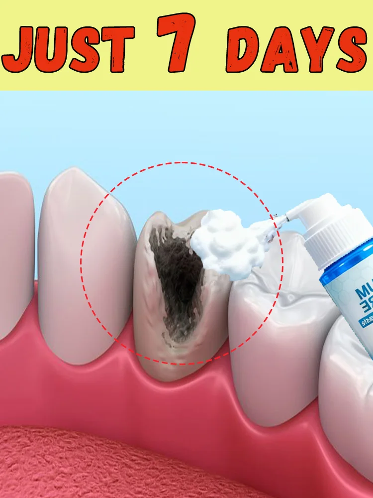 Outils de nettoyage intra-oraux, nettoyeur de mousse, outil de Mousse intra-orale, offre spéciale 2025