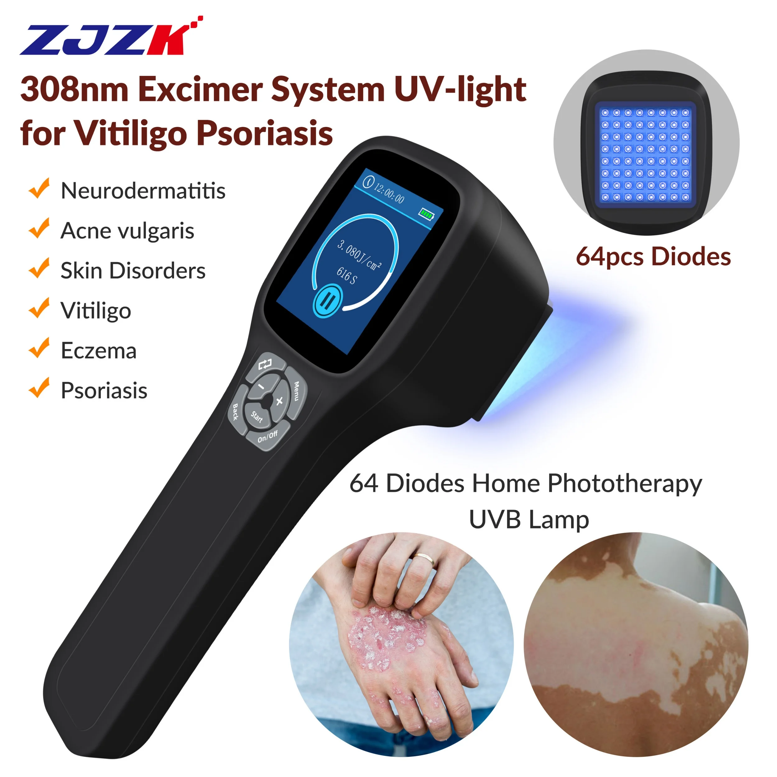 Medical 308 nm Excimer Narrowband UVB Narrow Band UV Light at Home Remedy Therapy Treatment for Eczema Vitiligo Skin Conditions