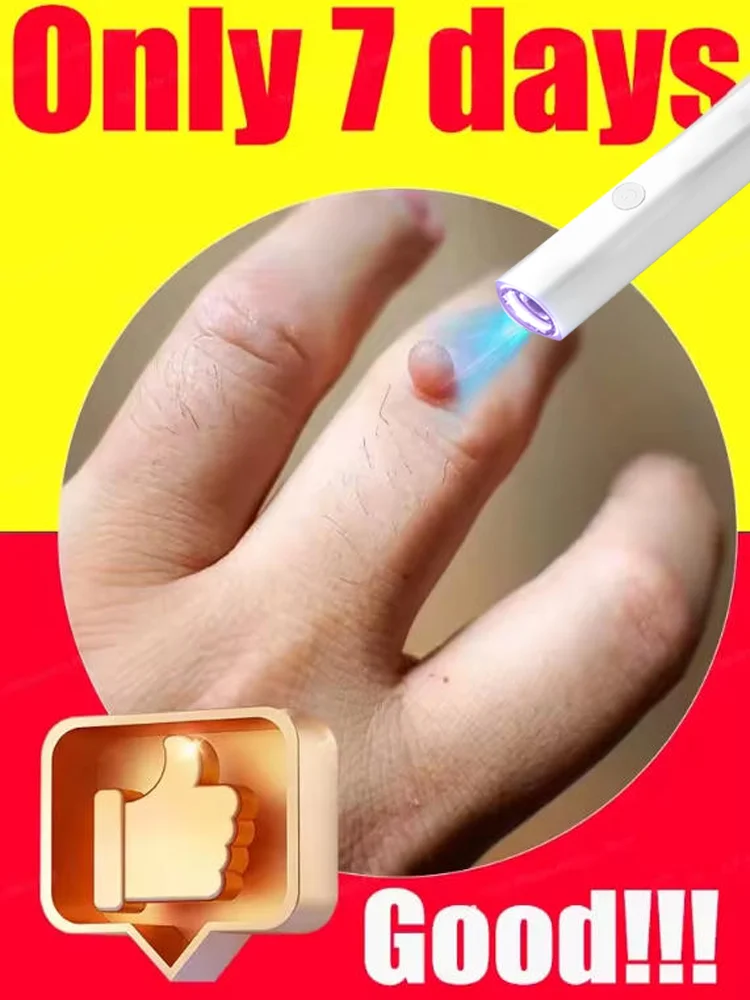 

2025 2nd ᵍᵉⁿᵉʳᵃᵗⁱᵒⁿ ᵘᵖᵍʳᵃᵈᵉᵈ wᵃʳᵗ ⸴ ᑫᵘⁱᶜᵏˡʸ， ʳᵉpᵃⁱʳ wᵃʳᵗˢ ʳᵒoᵗ