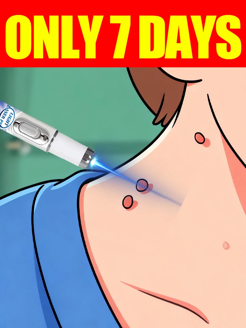 

Warts blue light tool, more discounts on sets