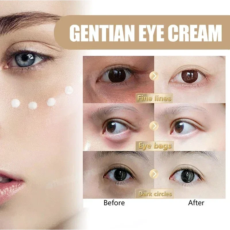 26 주름 개선 파인 라인 아이 백 리무버 주름 방지 아이 세럼 다크 서클 제거 푹신한 눈