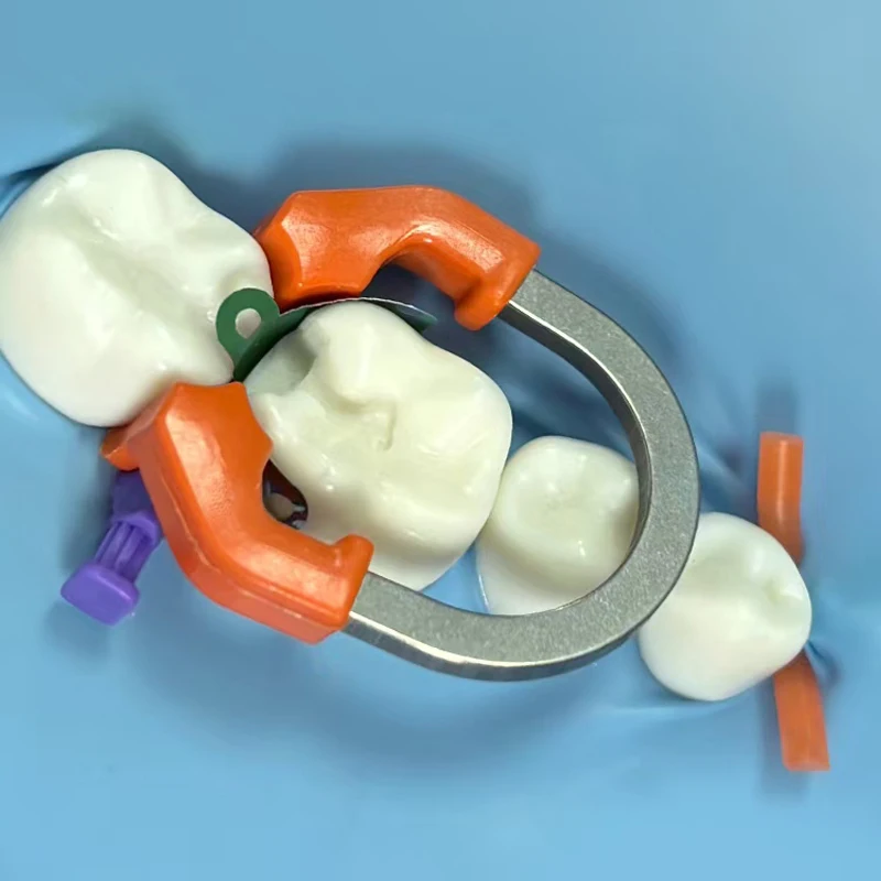 Dental Matrix Bands NiTi Metal Matrices Matrix Ring Sectional Contoured Matrix System Nickel Titanium Clamping Ring Dentist Tool