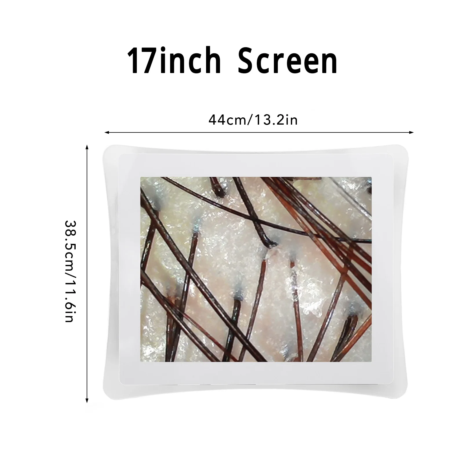 Huidfollikel Detector 17 inch Huid Haar Analysis Machine 50X 200X Vergroting 3 Lichtmodi Follikel Hoofdhuid Detectie Instrument