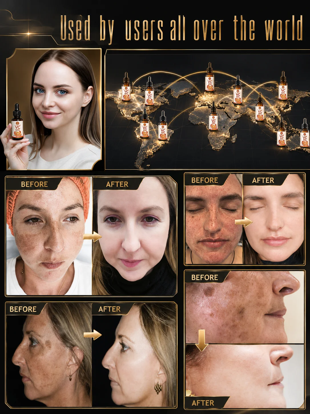 Vitamin C Face Serum, Dark Spots Removal Care for Freckles and Acne Marks, Hydrating Essence for Women and Men