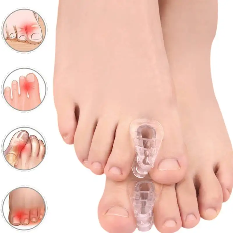 Toe Separator Hallux Valgus Splint Pedicure Tool Bunion Corrector Feet Care Bone Thumb Straightener Pedicure Orthosis 2Pair/4Pcs