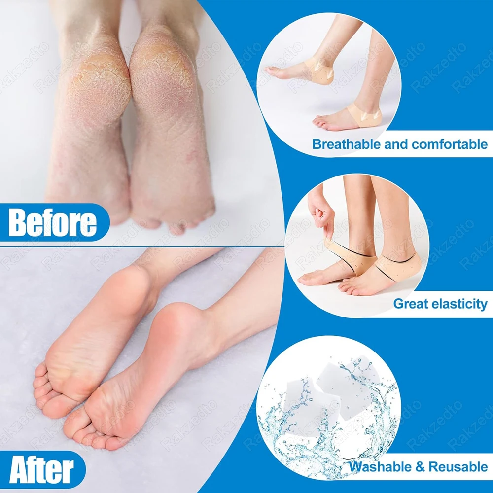 Thumbnail 3 - #15 Low Cost Heel Spurs That Work