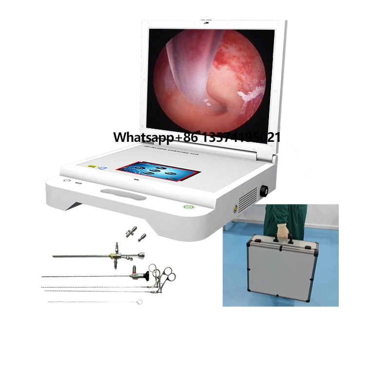 

Portable hd Endoscope Endoscopy System Set for Hysteroscope Gynecological
