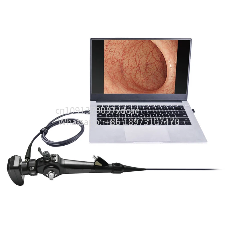 2026 New YSENMED YSVET-EU150H Veterinary Endoscope Catcher . Veterinary Vets Pets Dogs Cats Ear Rigid Endoscope Optics Oto