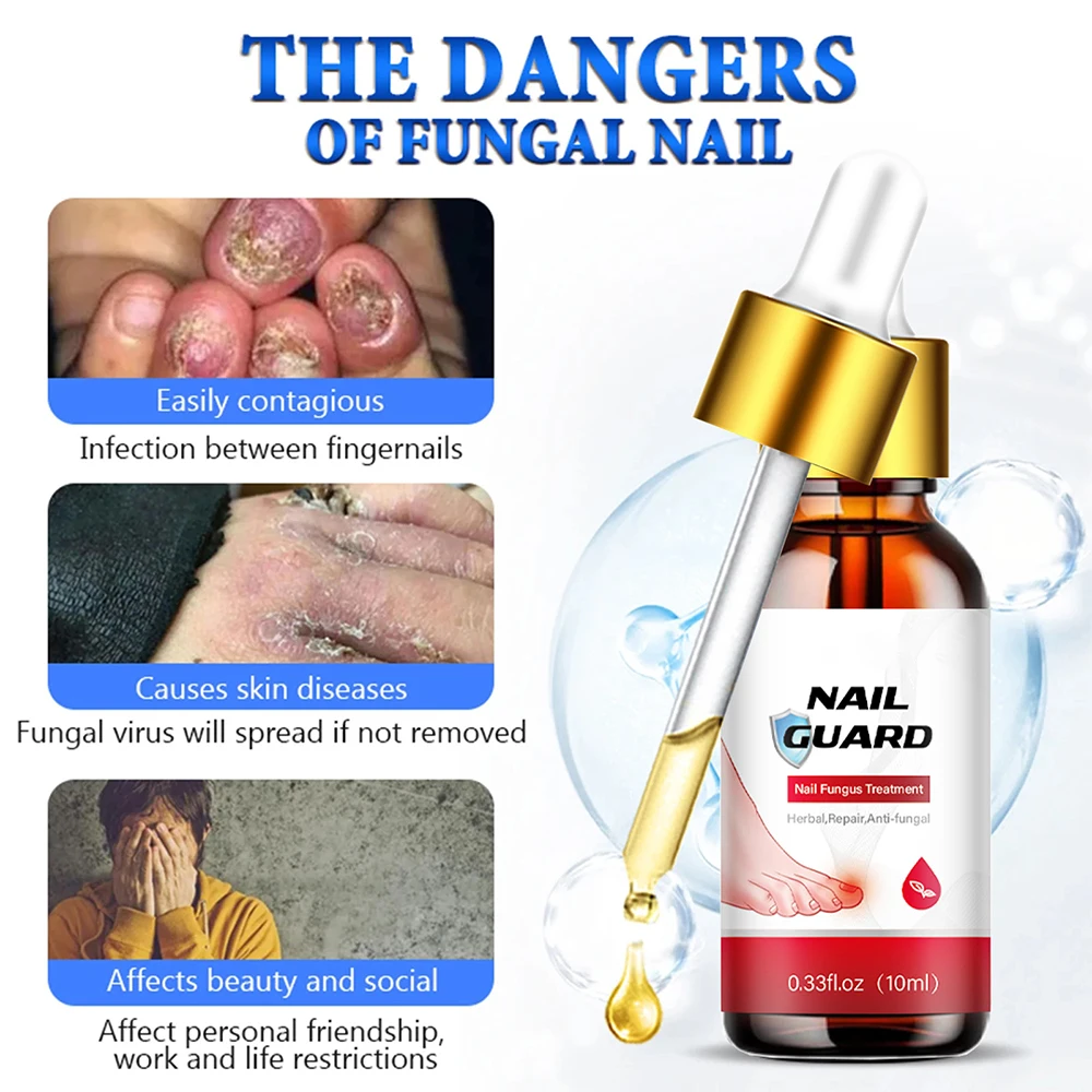 Nail Fungus Treatment Device Repair Toenail Fingernail Treat Toenail Nail Fungal Treatment Essential Oil Onychomycosis