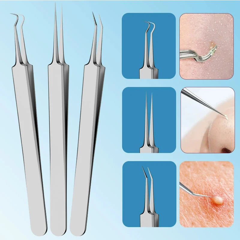 Kit removedor de cravo de aço inoxidável, 15 peças, conjunto de ferramentas de espinhas com extrator de comedone, pinças de acne, agulhas de beleza para cuidados faciais
