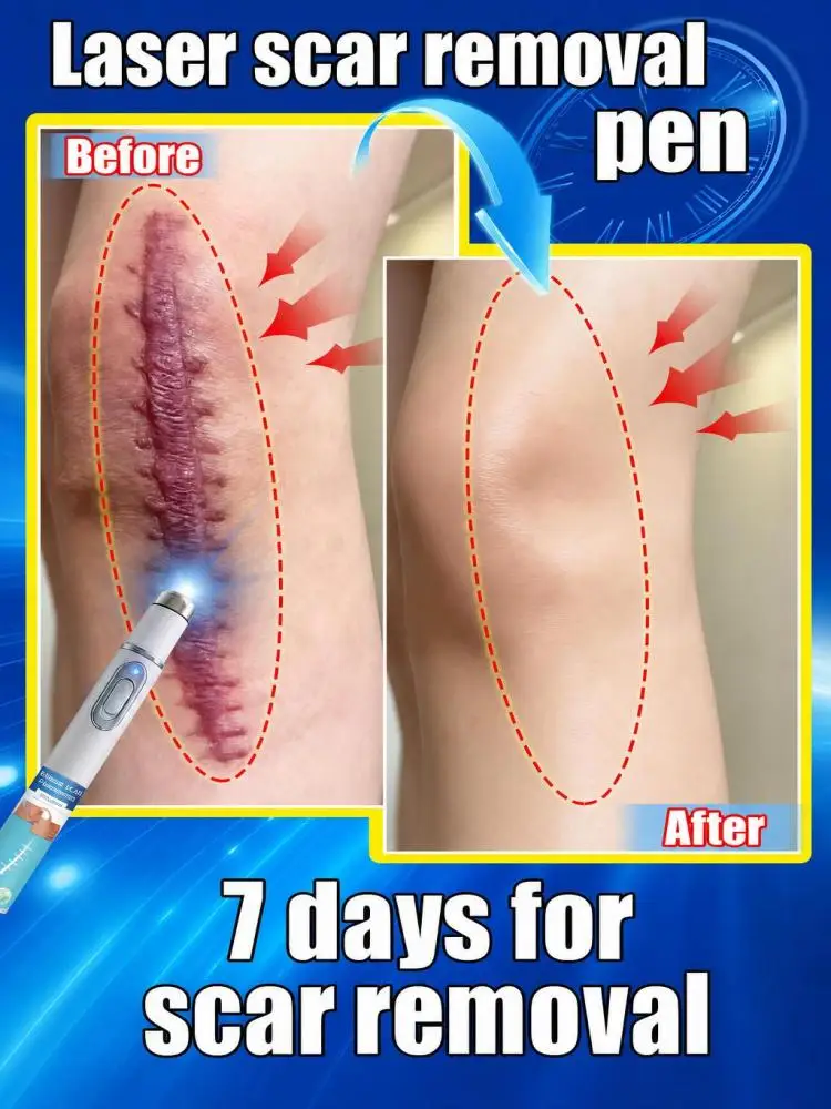 Scar Care Product - Effective Solution for Mark Removal - Try This Scar Reduction Treatment Today