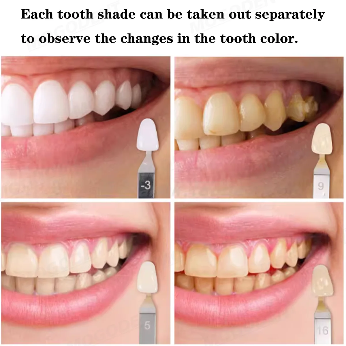 3D Master Dental Whitening Com - Teeth Whitening Shade Guide review and price