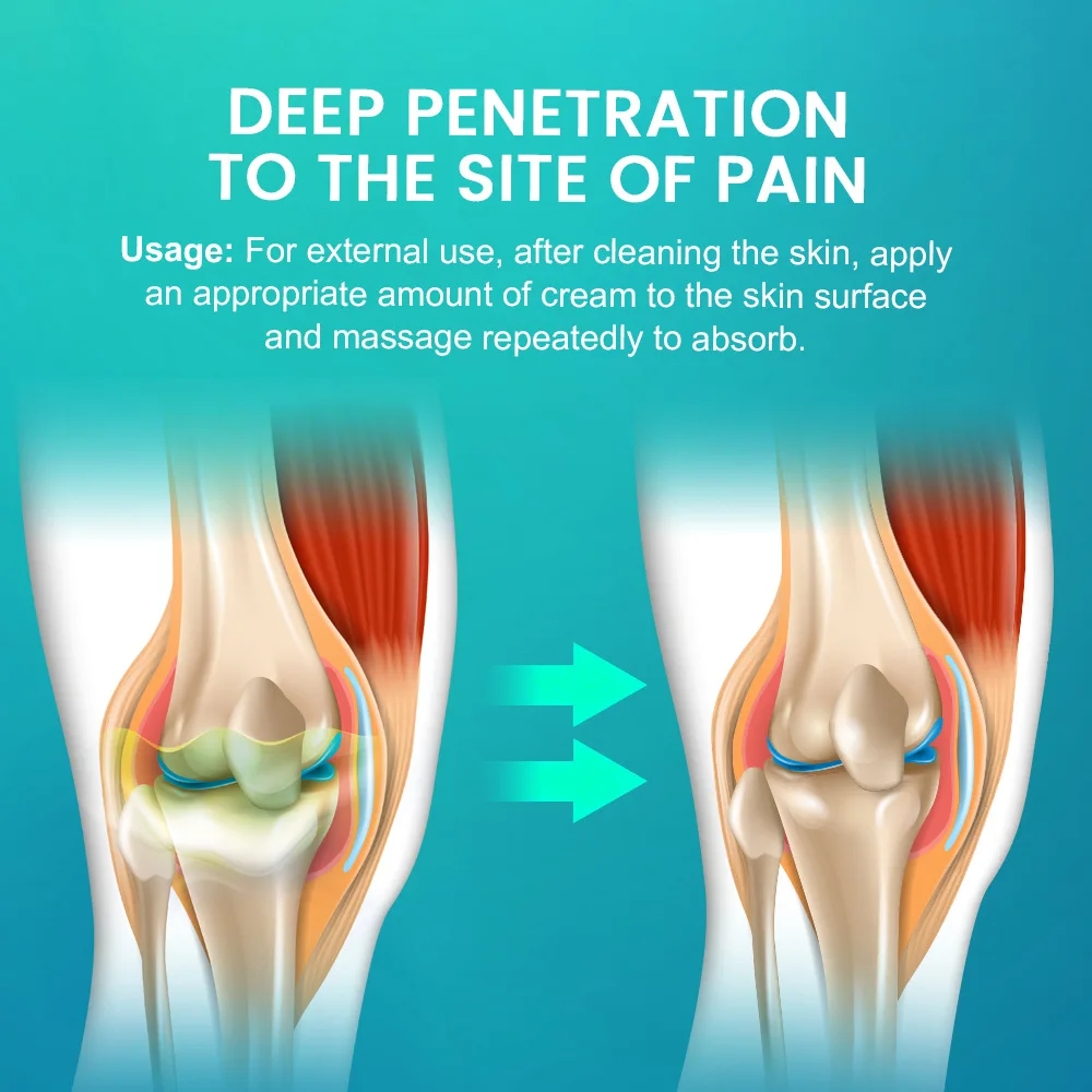 مرهم تراكم سائل الركبة، مرهم اختراق العظام، الجص K10299