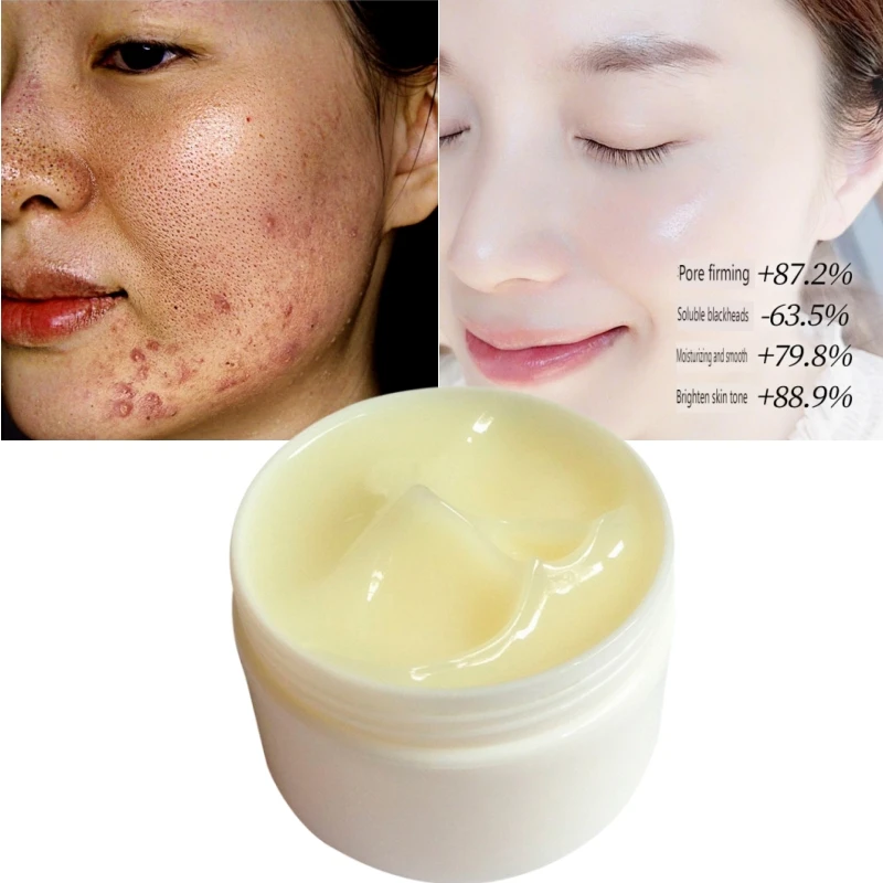 Nicotinamide Witch Hazel Shrink Pores Cream Acne Hydrating Moisturizer Intensive Repair Cream for All Skin Types