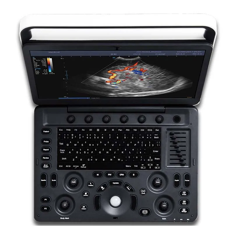 Sonoscape Color Doppler 3D 4D High Quality Portable Laptop Medical Ultrasound Machine Price Instruments E1