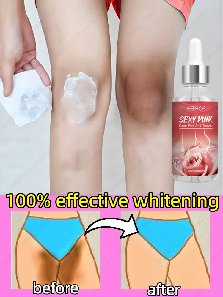 

Whitening Cream Private Parts Underarm Bleaching Serum Whiten Butt Knee Brighten Inner Thigh Intimate Parts Dark Remove Melanin