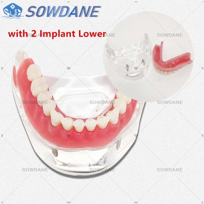 Dental Study Teaching Model Dental Impant Standard Model Removable Teeth ADULT Child TYPODONT Model  Dentist Communication Model