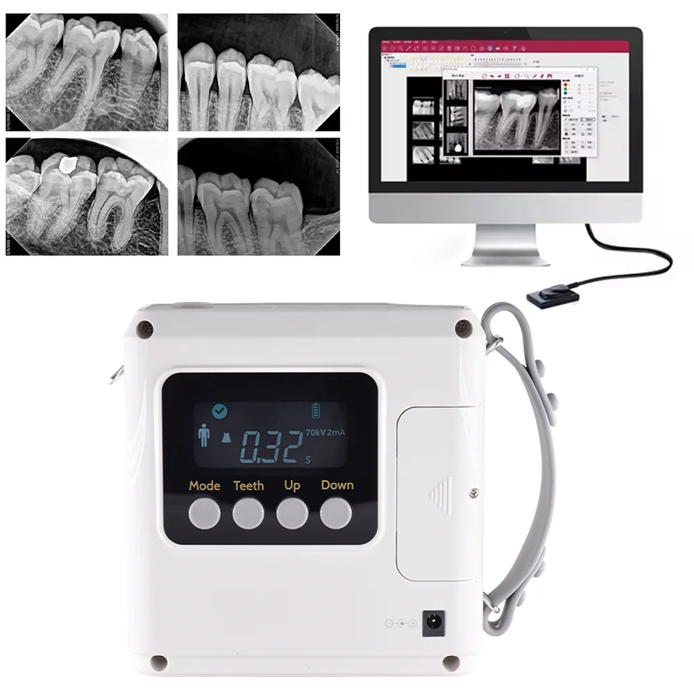 Mexico RU EU US 70KV High Frequency Dental X-Ray Unit Low Radiation Portable Dental X Ray Machine Imaging System