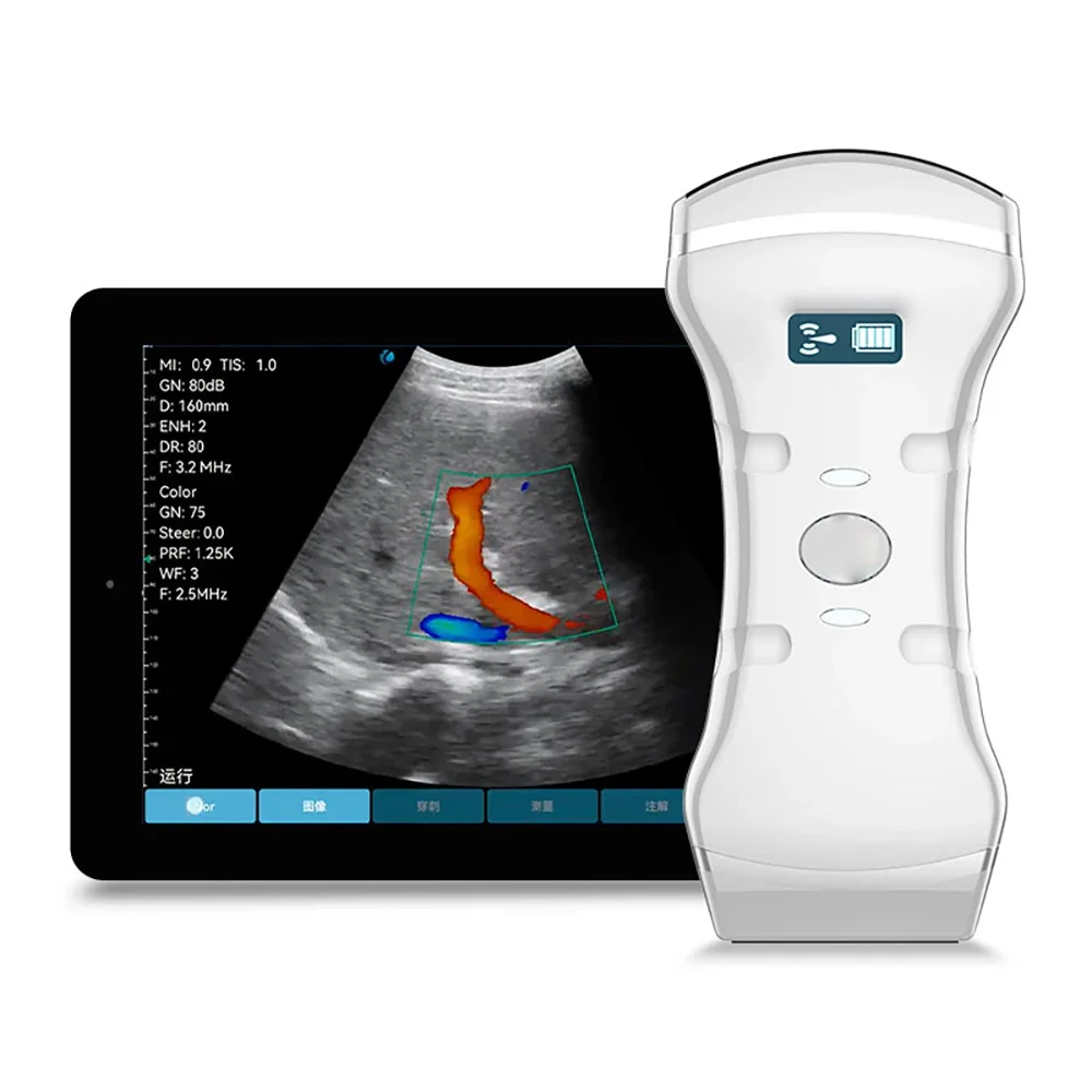 

3 in 1 Color Doppler Ultrasound Dual Head Convex and Linear Handheld Ultrasound Probe for Cardiac/Artery/Kidneys/Liver/Thyroid