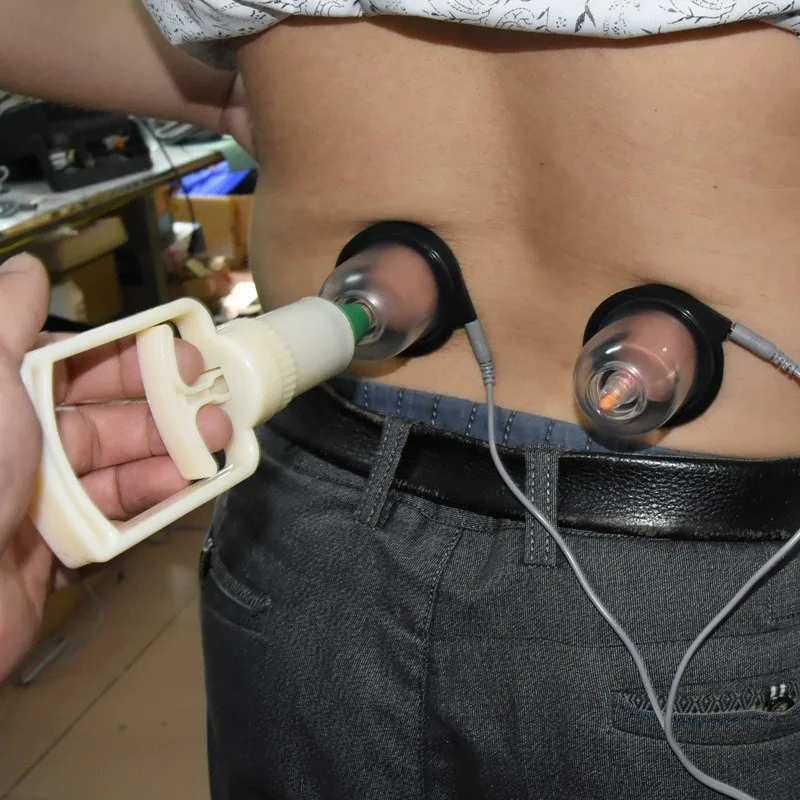 Electric Cupping Electrotherapy Electrode Cupping Vacuum Electroacupuncture Electrode Suction Tanks Body Massage Acupuncture Cup