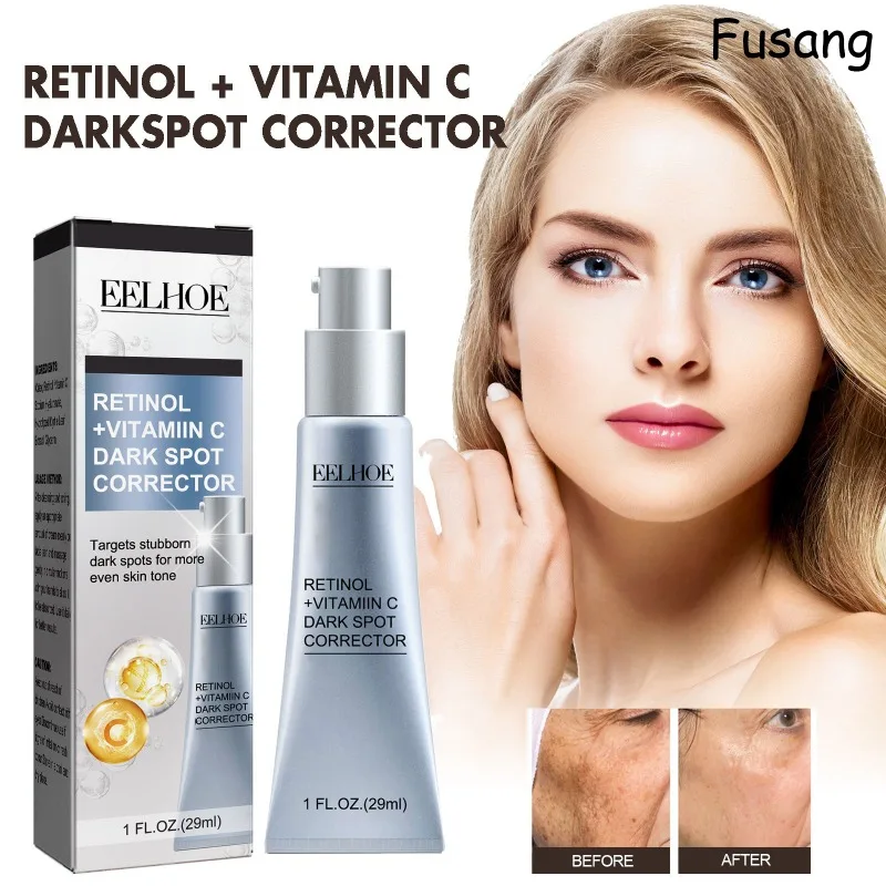 

Retinol Brightening Chloasma Cream Effective Lightening Dull Skin Brighten Cream Face Fade Melasma Korean Moisturizing Skin Care