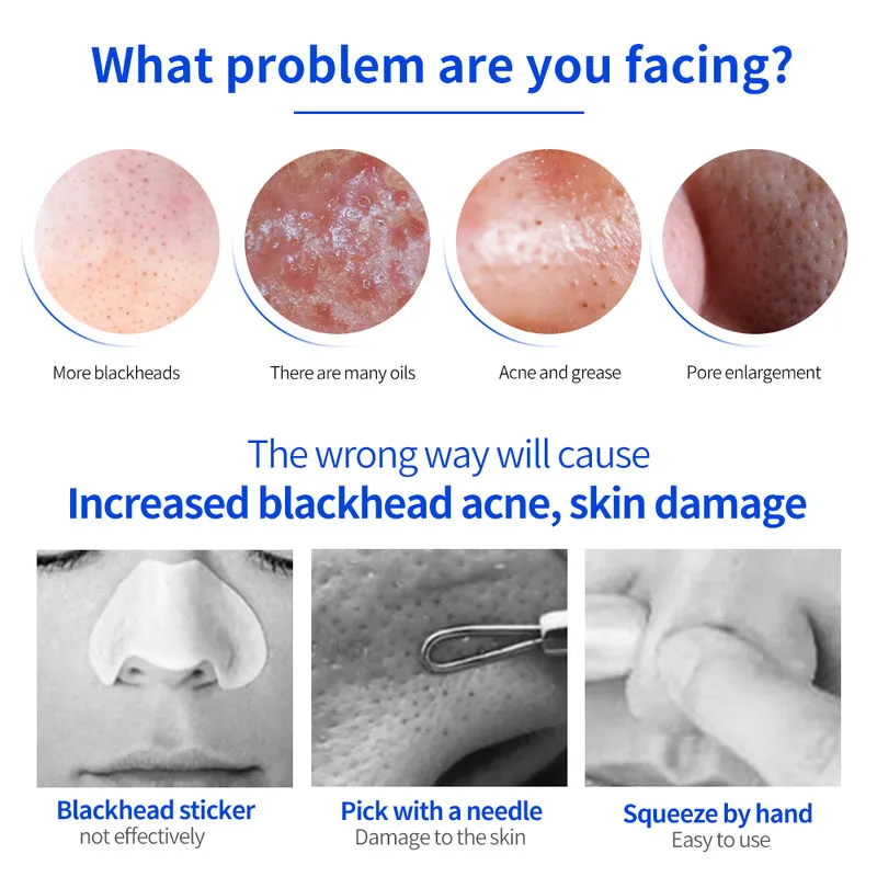 

1Pcs Professional Electric Pore Suction Device Facial Beauty Cleaner for Dead Skin Oil Makeup Residue Removal