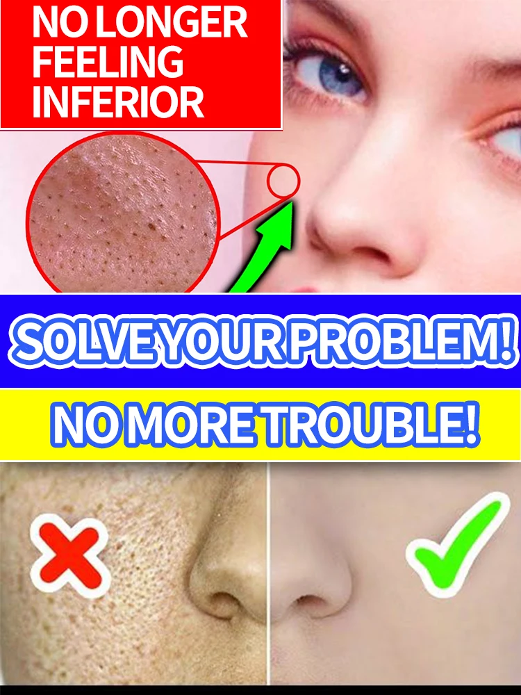 

Solve Large Pore Problems