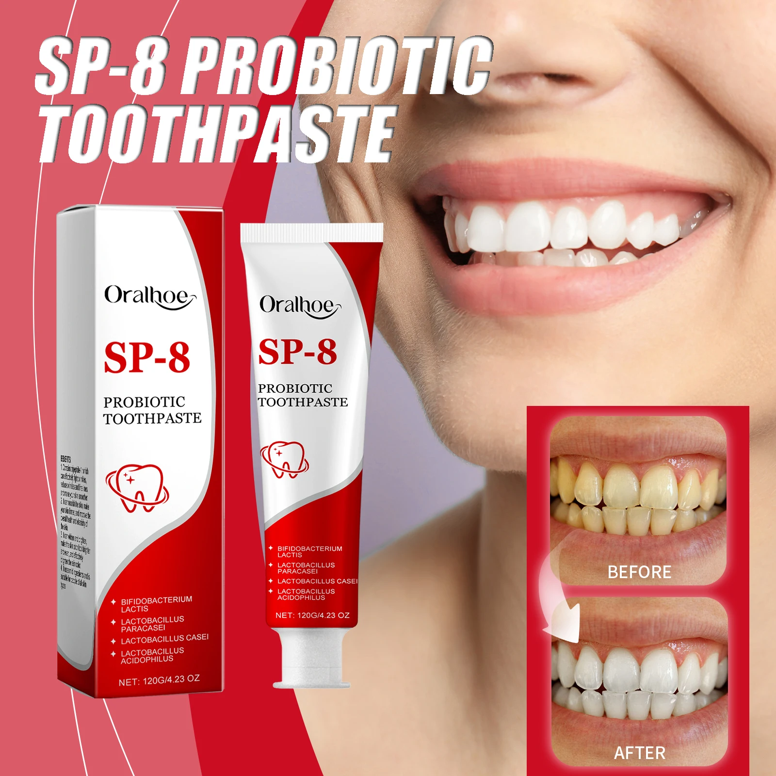 

Зубная паста Sp-8, пробиотическая, глубокая очистка, удаление налета, улучшение кариеса зубов, защита десен, долговечная зубная паста для ухода за полостью рта