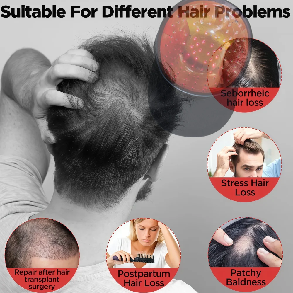 

Эффективная шапочка для быстрого роста волос, терапия красным светом 650 нм с зарядкой через USB и массажером для кожи головы против выпадения волос