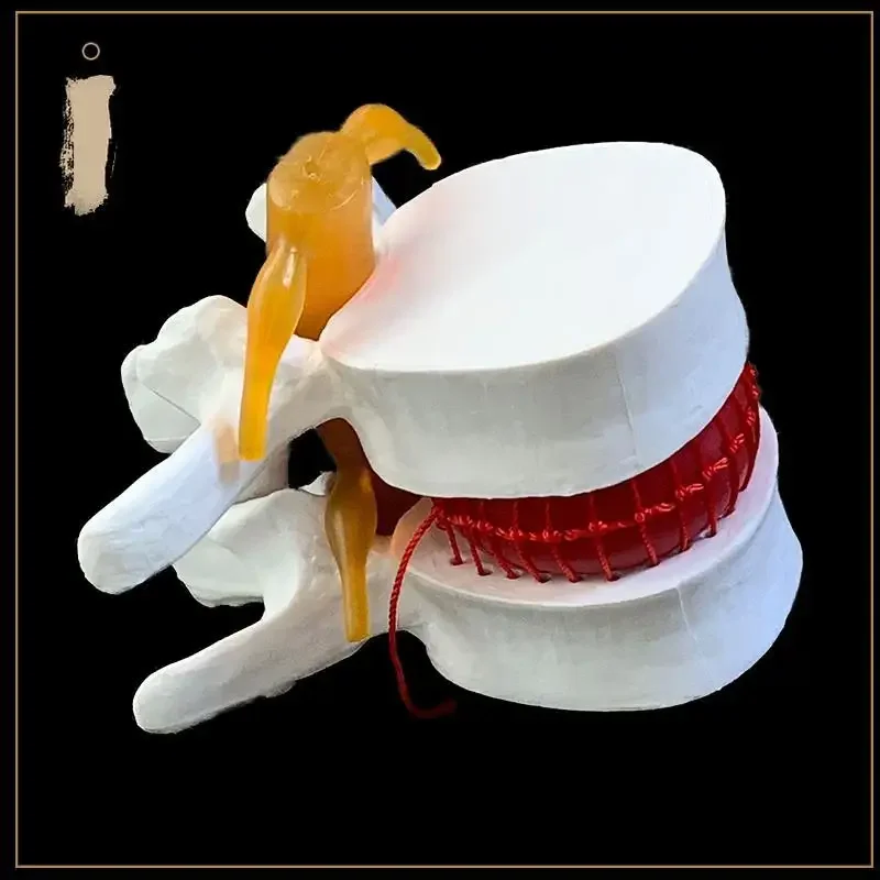 

Demonstration Model Of Human Lumbar Intervertebral Disc, Lumbar Spine Model, Spinal Model, Joint Model